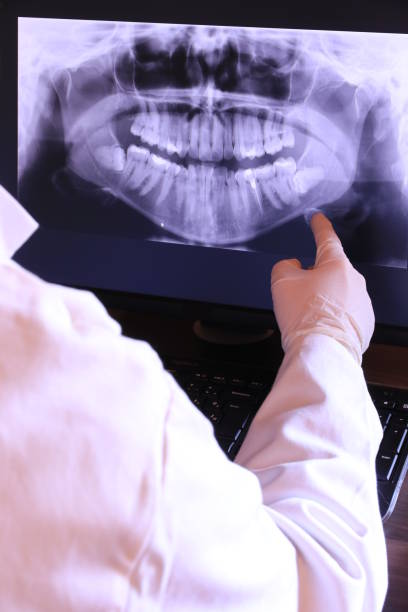 Best Emergency Root Canal Treatment in Anthony, NM