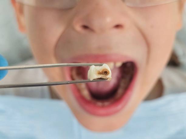 Best Emergency Dental Care for Abscessed Tooth in Anthony, NM